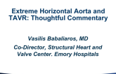 Extreme Horizontal Aorta and TAVR: Thoughtful Commentary on the Case