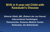 Kawasaki Disease Treated With BRS