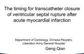 TCT 5: Timing for Transcatheter Closure of Ventricular Septal Rupture After Acute Myocardial Infarction