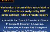 TCT 43: Mechanical Abnormalities Associated With Drug-Eluting Stent Thrombosis Analyzed by Optical Coherence Tomography in the National PESTO French Registry