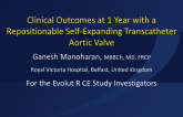 TCT 98: Clinical Outcomes at 1-Year With a Repositionable Self-Expanding Transcatheter Aortic Valve