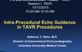 Intra-Procedural Echo Guidance in TAVR Procedures