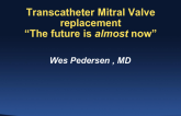 Percutaneous MV Replacement: The Future Is (Almost) Now