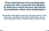 TCT 54: A Comparison of Three-dimensional Echocardiography and Computed Tomography in Sizing the D-Shaped Mitral Annulus Before Transcatheter Mitral Valve Implantation