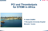 PCI and Thrombolysis for STEMI in Africa