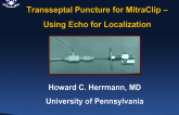 Case 1: Transseptal Puncture With MitraClip