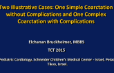 Two Illustrative Cases: One Simple Coarctation Without Complications and One Complex Coarctation With Complications