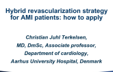 Hybrid Revascularization Strategy for AMI Patients: How to Apply
