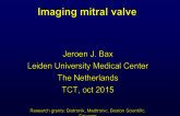 CT vs Echo Mitral Valve Imaging