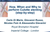 How, Why, and When to Perform: Culotte Stenting (Step-by-Step)