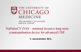 NuPulse iVAS - A Minimally Invasive Advanced CHF Device