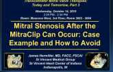 Mitral Stenosis After the MitraClip Can Occur: Case Example and How to Avoid