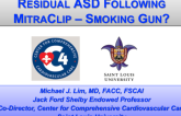 ASD After MitraClip: Is This the Smoking Gun?
