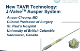 New TAVR System: J-Valve  Technology Review and Clinical Update