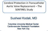 Cerebral Embolic Protection Devices: Sentinel Dual Filter Device  Update of US Pivotal Clinical Trial