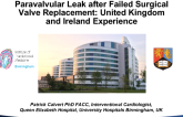 Evaluation of Percutaneous Closure of Paravalvular Leak After Failed Surgical Valve Replacement: The UK and Irish Experience