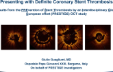 PRESTIGE: Optical Coherence Tomography Findings in Patients Presenting With Stent Thrombosis