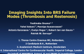 Imaging Insights Into BRS Failure Modes (Thrombosis and Restenosis)