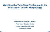 Matching the 2-Stent Technique to the Bifurcation Lesion Morphology