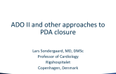 ADO II and Other Approaches to PDA Closure