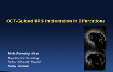 OCT-Guided BRS Implantation in Bifurcations