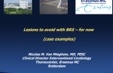 Lesions to Avoid With BRS  For Now! (Case Examples)