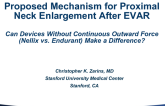Proposed Mechanisms for Proximal Neck Enlargement After EVAR: Can Devices Without Continuous Outward Force (Nellix vs Endurant) Make a Difference?