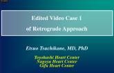 Edited Video Case 1 of Retrograde Approach