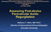 Assessing Postdevice Paravalvular Aortic Regurgitation
