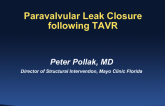Case 4: Aortic Paravalvular Leak Closure  After TAVR