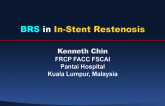 BRS in In-Stent Restenosis