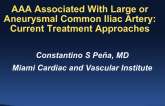 AAA Associated With Large or Aneurysmal Common Iliac Artery: Current Treatment Approaches