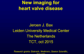 New Noninvasive Methods for Assessing Valvular Heart Disease