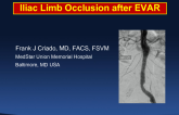 Graft Limb Occlusion After EVAR: A Historical Footnote?
