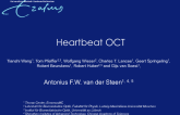 OCT Technological Trends 2: Heart-Beat OCT  Micro Motor System Technology
