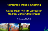 Edited Video Case 2 of Retrograde Approach