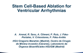 Stem CellBased Ablation for Ventricular Arrhythmias