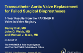 PARTNER II Valve-in-Valve Registry: Evaluation of a Balloon-Expandable Transcatheter Aortic Valve in Patients With Failed Bioprosthetic Surgical Aortic Valves