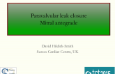 Case 1: Mitral Paravalvular Leak Closure  Antegrade Approach
