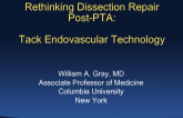 Featured Vascular Innovation Technologies 4: Rethinking Dissection Repair Post-PTA  Tack-It Endovascular Technology