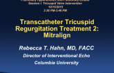 Transcatheter Tricuspid Regurgitation Treatment 2: Mitralign