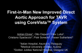 First-in-Man New Improved Direct Aortic Approach for TAVR using CoreVista System