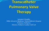 Transcatheter Pulmonary Valve Therapy