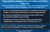 A New TAVR System for Predominant Aortic Regurgitation Implantation of J-Valve and Early Outcome