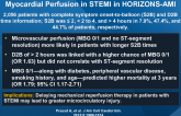 Effect of Ischemia Duration and D2B Time on Myocardial Perfusion in STEMI in HORIZONS-AMI