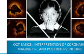 OCT Basics: Interpretation of Coronary Imaging Pre and Post Interventions