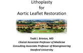 Lithoplasty for Aortic Leaflet Restoration