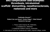 BRS complication case examples:  thrombosis, intraluminal scaffold  dismantling, neoatherosclerosis, restenosis and more
