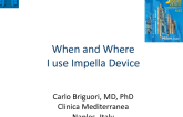 When and Where I use Impella Device