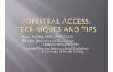 Popliteal Access: Tecniques and Tips